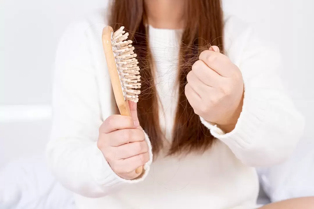 Perte de cheveux et traitement avec un spray verdexedil